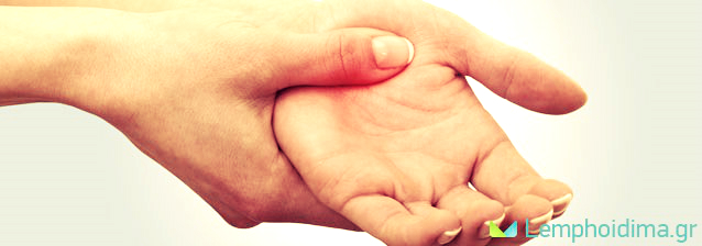 ΛΕΜΦΟΙΔΗΜΑ ΡΕΥΜΑΤΟΕΙΔΗΣ ΑΡΘΡΙΤΙΔΑ